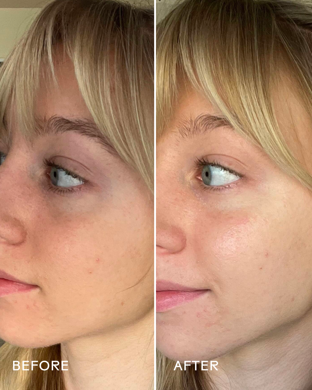 Three Ships Brighter Days eye masks before after