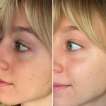 Three Ships Brighter Days eye masks before after