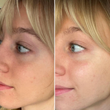 Three Ships Brighter Days eye masks before after
