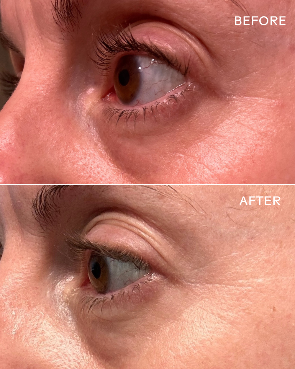 Three Ships Eye Hero Eye Cream before after