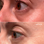 Three Ships Eye Hero Eye Cream before after
