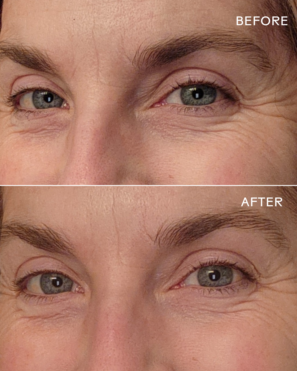 Three Ships Eye Hero Eye Cream before after