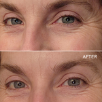 Three Ships Eye Hero Eye Cream before after