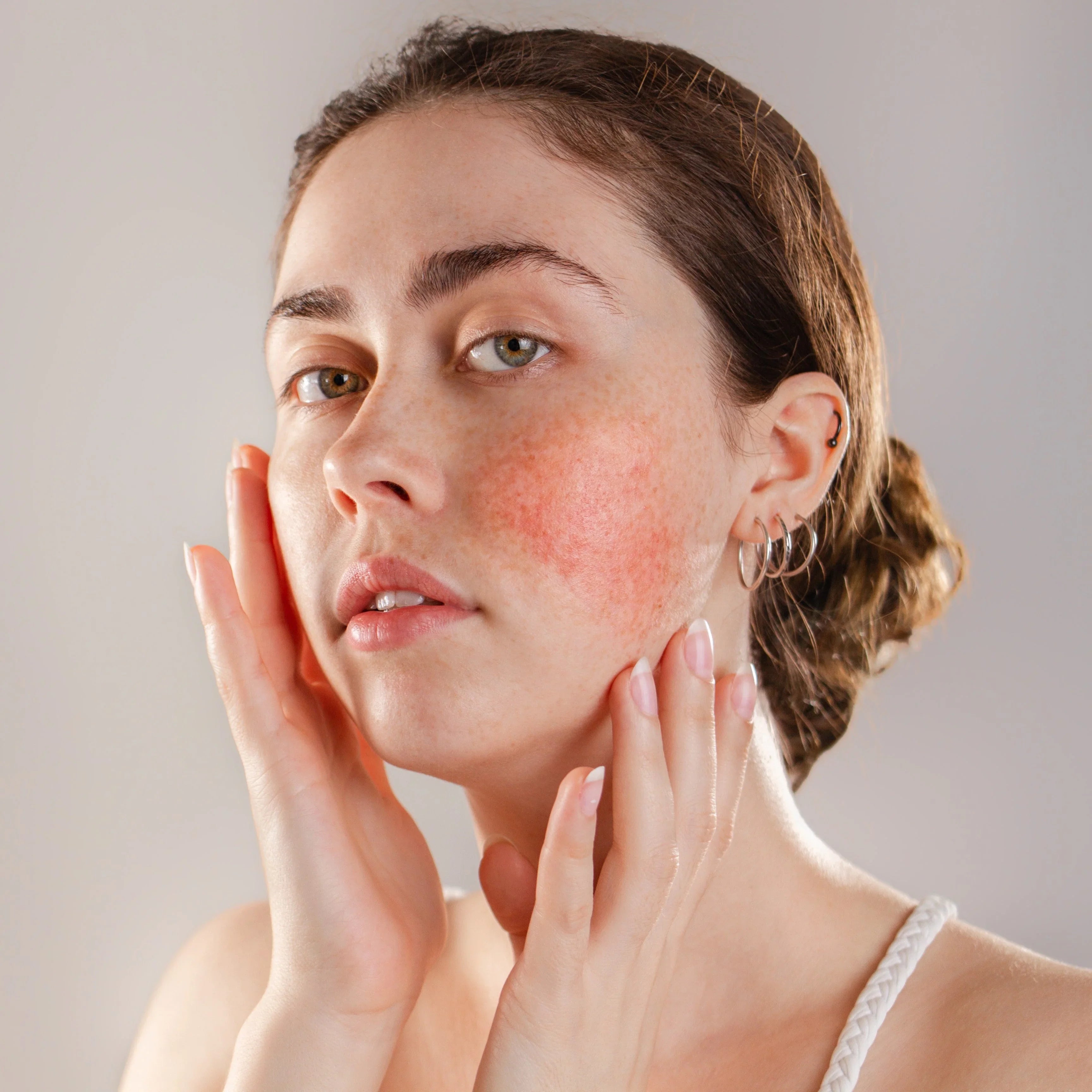 Reactive and Sensitive Skin Care