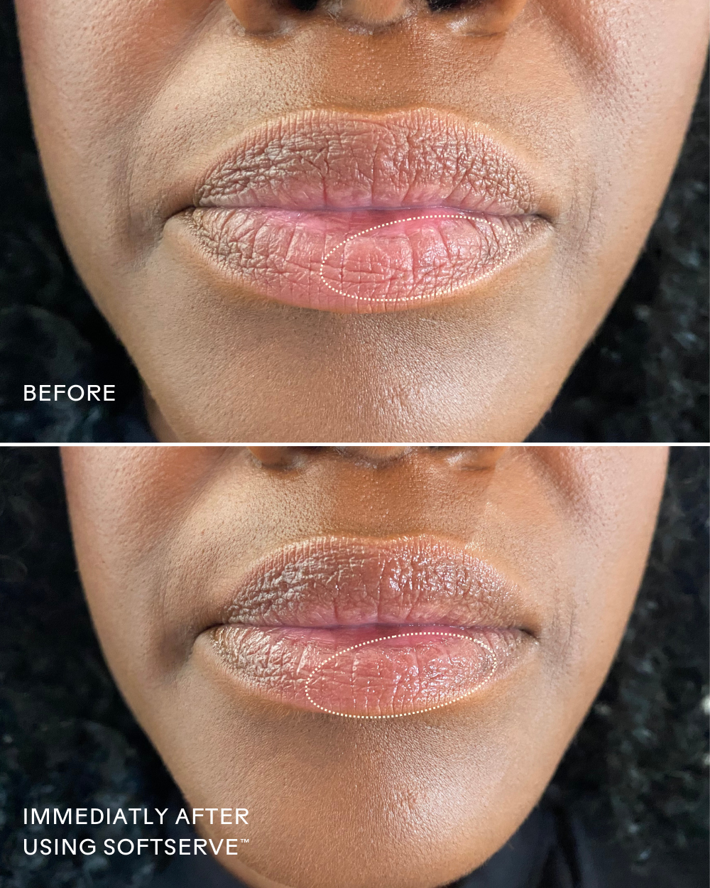 Before and after comparison of lips using Three Ships Soft Serve product on a black textured background.