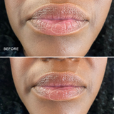 Before and after comparison of lips using Three Ships Soft Serve product on a black textured background.